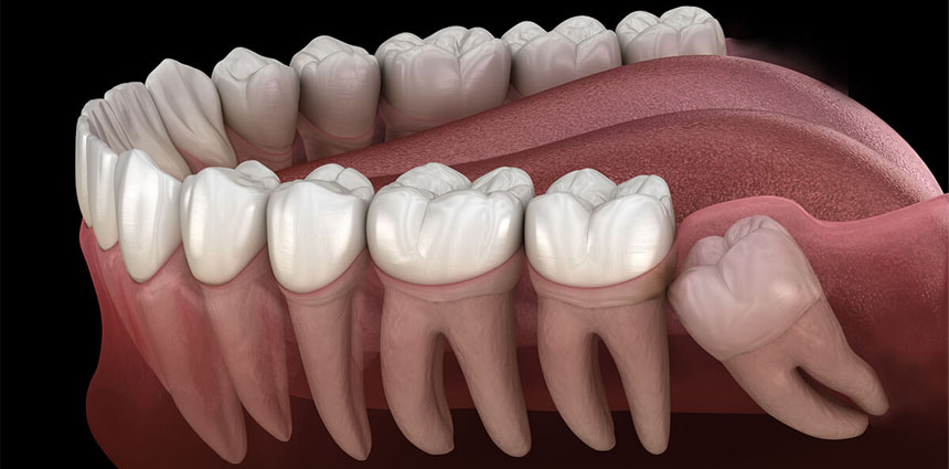 Smile excellence in Ahmedabad