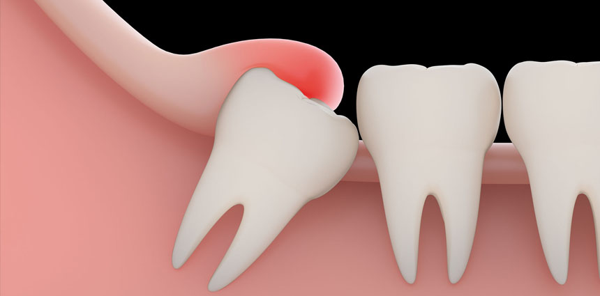 Best Cosmetic Dentistry in Ahmedabad