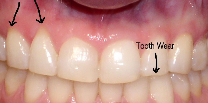 Smile excellence in Ahmedabad