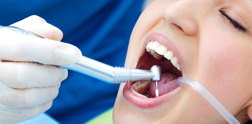Doctors for Teeth Grinding in Ahmedabad