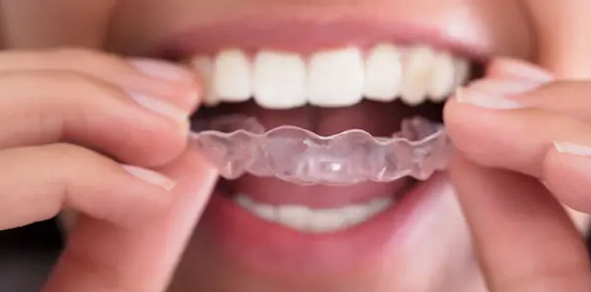 Dental Clinic in Ahmedabad