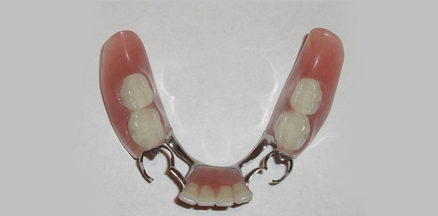 Denture Cost in ahmedabad
