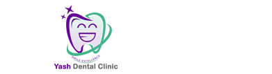 tooth implant treatment in ahmedabad
